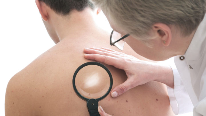 Campanha contra a Hanseníase em Caruaru