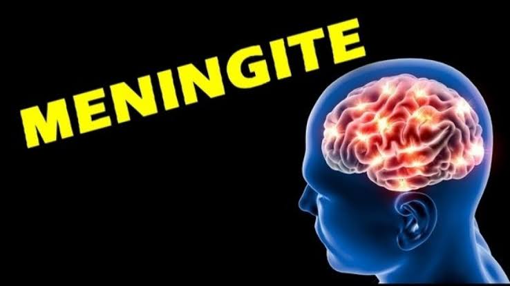Criança e adolescente de Cachoeirinha morrem por meningite em Caruaru e Bezerros Criança e adolescente de Cachoeirinha morrem por meningite em Caruaru e Bezerros