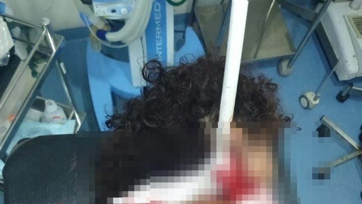 Morre no Hospital da Restauração mulher esfaqueada pelo irmão em Caruaru