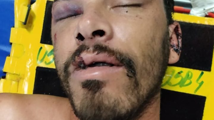 HRA procura familiares de paciente em estado grave