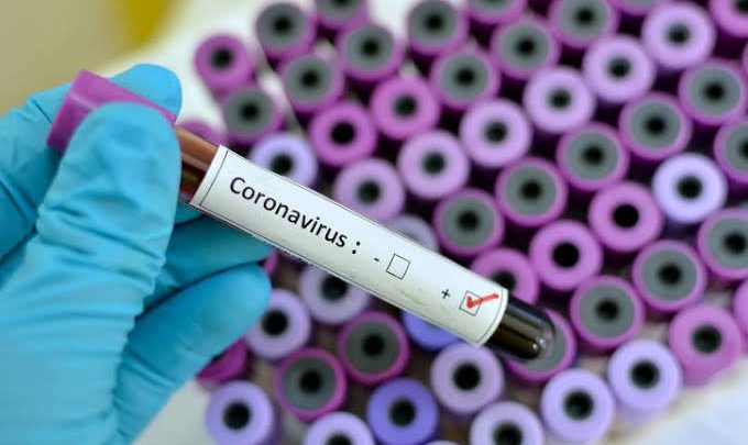Conoravírus: Sobe para 18 número de infectados em Pernambuco e Belo Jardim tem um caso confirmado