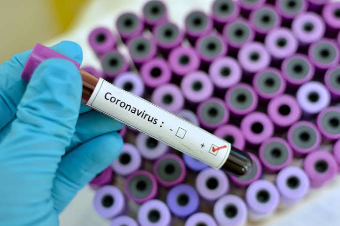 Conoravírus: Sobe para 18 número de infectados em Pernambuco e Belo Jardim tem um caso confirmado Conoravírus: Sobe para 18 número de infectados em Pernambuco e Belo Jardim tem um caso confirmado