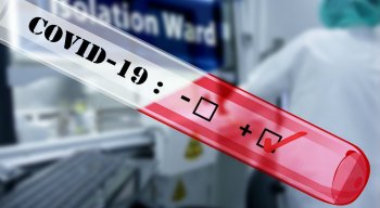 Pernambuco tem mais 762 recuperados da Covid-19 totalizando 27.903