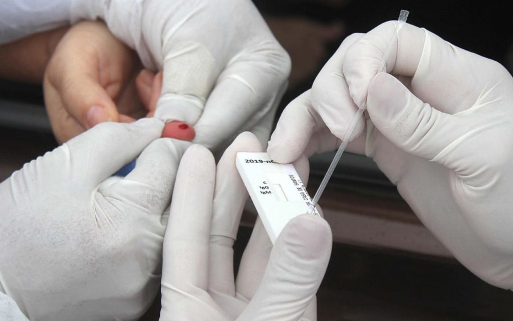 Número de recuperados do coronavírus ultrapassa os casos ativos no Brasil Número de recuperados do coronavírus ultrapassa os casos ativos no Brasil