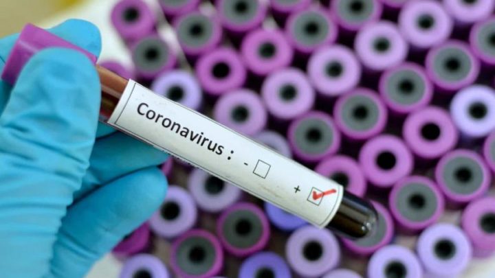 Caruaru: Nenhum óbito nas últimas 24 horas por Covid-19 e mais 94 recuperados