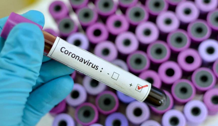 Caruaru: Nenhum óbito nas últimas 24 horas por Covid-19 e mais 94 recuperados Caruaru: Nenhum óbito nas últimas 24 horas por Covid-19 e mais 94 recuperados
