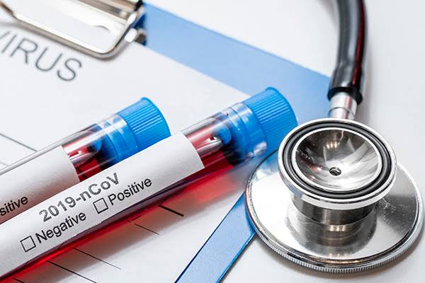 Caruaru não registra óbito por Covid-19 nas últimas 24 horas e tem mais 20 recuperados da doença Caruaru não registra óbito por Covid-19 nas últimas 24 horas e tem mais 20 recuperados da doença