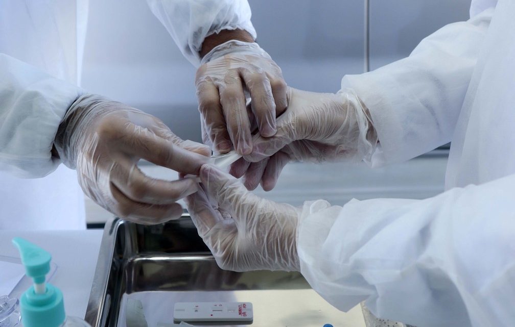 Brasil tem 649.908 recuperados de Covid-19 número superior à quantidade de casos ativos no país Brasil tem 649.908 recuperados de Covid-19 número superior à quantidade de casos ativos no país