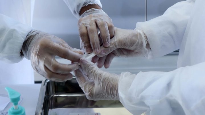 Brasil tem 649.908 recuperados de Covid-19 número superior à quantidade de casos ativos no país