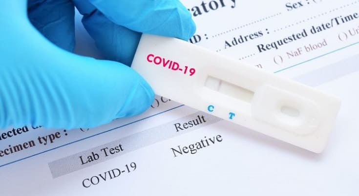 Caruaru registra mais 60 casos positivos e mais 02 óbitos por Covid-19 Caruaru registra mais 60 casos positivos e mais 02 óbitos por Covid-19