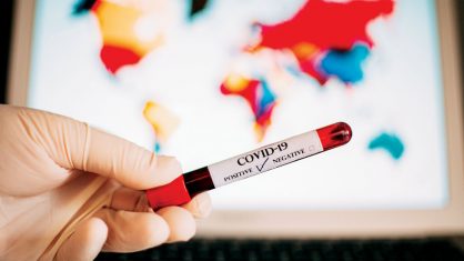 Secretaria de Saúde-PE divulga mais 1.414 casos de Covid-19 no Estado Secretaria de Saúde-PE divulga mais 1.414 casos de Covid-19 no Estado