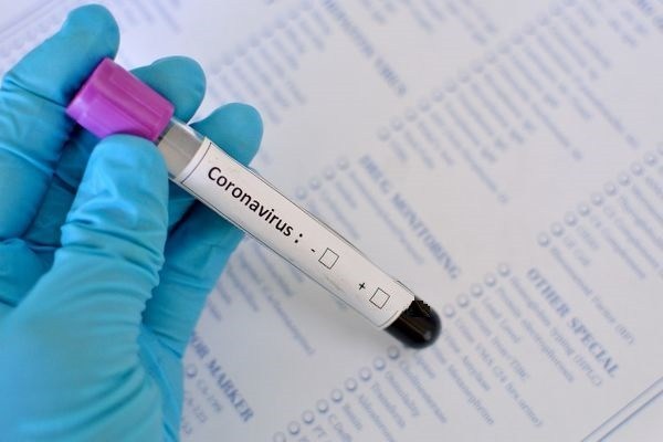 Caruaru registra mais 27 casos positivos e mais 5 óbitos por Covid-19 Caruaru registra mais 27 casos positivos e mais 5 óbitos por Covid-19