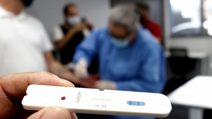 Secretaria de Saúde de Caruaru divulga mais 109 casos de Covid-19 e mais 3 óbitos
