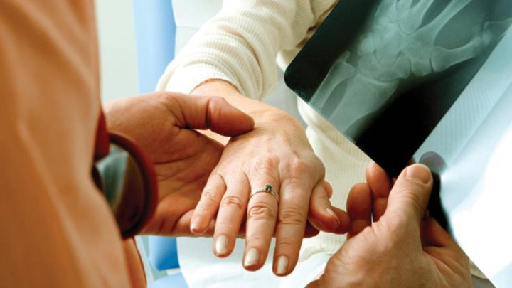 Pacientes autoimunes devem ter atenção especial durante a pandemia