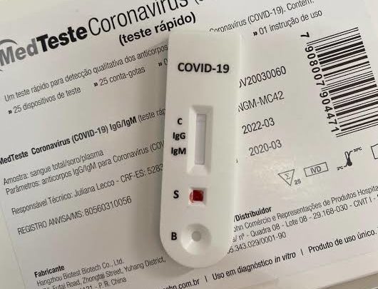 PE testa pessoas que apresentarem sintomas leves da Covid-19 a partir desta quarta (15)