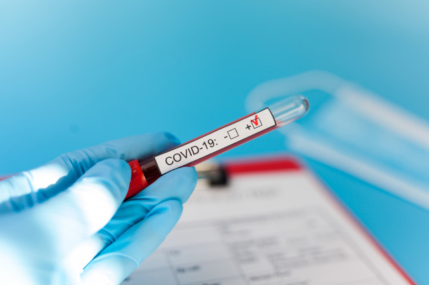 Caruaru tem 2.183 pacientes recuperados de Covid-19 Caruaru tem 2.183 pacientes recuperados de Covid-19