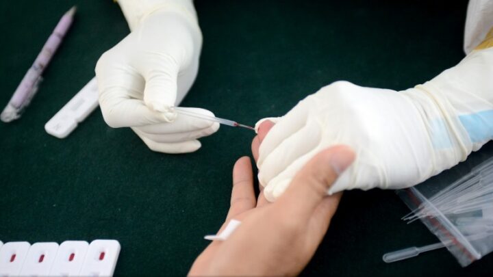 Diminui o número de casos de Covid-19 e aumenta o número de óbitos nas últimas 24 horas em Caruaru
