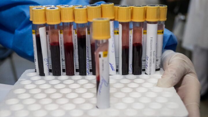 Caruaru tem mais de 5 mil pacientes recuperados de Covid-19