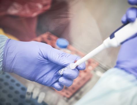 Caruaru registra 71 novos casos e uma morte por Covid-19 nas últimas 24 horas