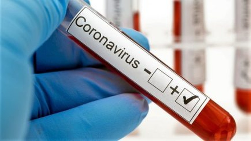 Caruaru registra mais 77 novos casos de covid-19 e uma morte Caruaru registra mais 77 novos casos de covid-19 e uma morte