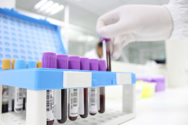 Caruaru registra mais 68 casos de Covid-19 e mais 67 recuperados nas últimas 24 horas Caruaru registra mais 68 casos de Covid-19 e mais 67 recuperados nas últimas 24 horas