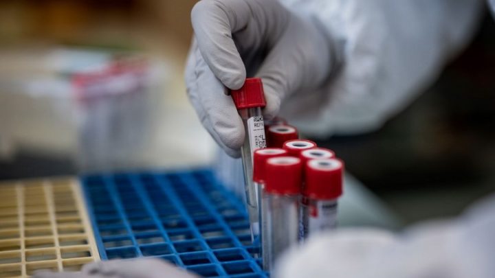 Nordeste pode ter segunda onda de Covid-19 nos próximos meses, alerta comitê