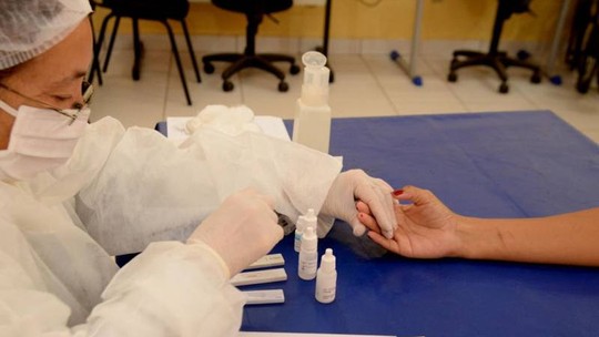 Pernambuco confirma 579 novos casos de covid-19 e 12 mortes