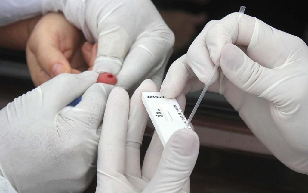 Caruaru registra 48 novos casos de covid-19 e duas mortes Caruaru registra 48 novos casos de covid-19 e duas mortes
