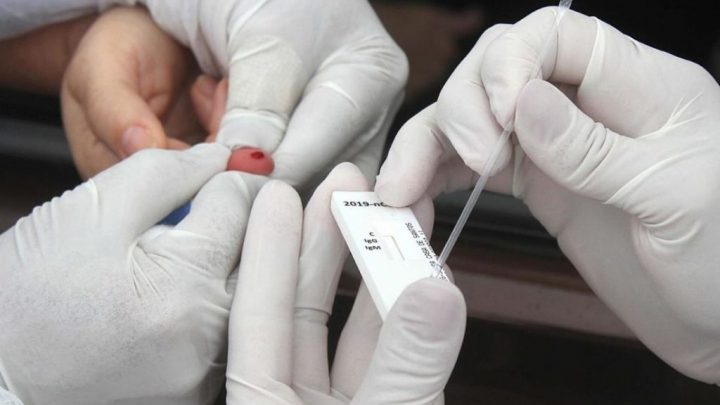 Caruaru registra 48 novos casos de covid-19 e duas mortes