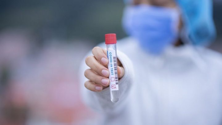 Caruaru registra 43 novos casos de covid-19 e uma morte
