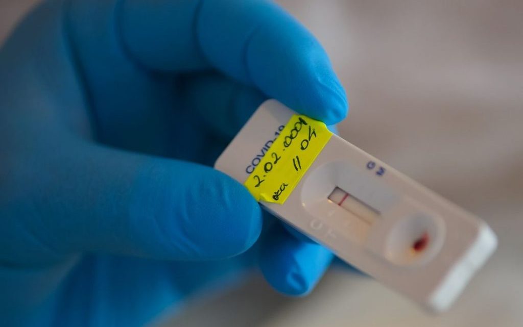 Secretaria de Saúde de Caruaru registra 7 novos casos de Covid-19 e mais duas mortes