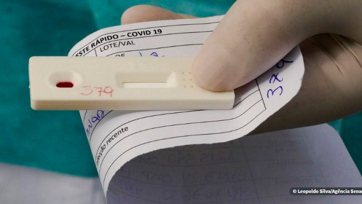 Pernambuco confirma 724 novos casos de covid-19