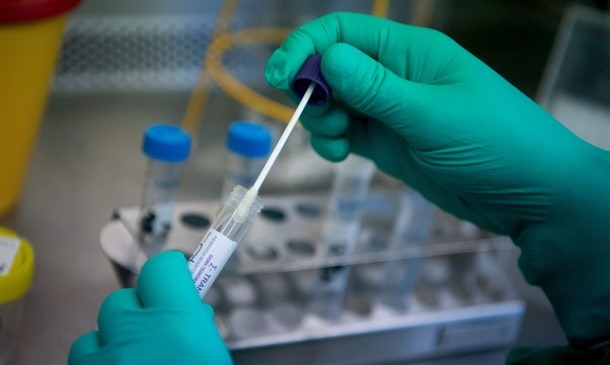 Registrados 73 novos casos de covid-19 em Caruaru e nenhuma morte Registrados 73 novos casos de covid-19 em Caruaru e nenhuma morte