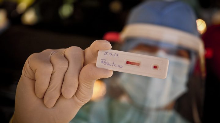 Pernambuco registra 106 novos casos de covid-19 e sete mortes neste domingo