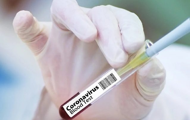 Secretaria de Saúde-PE registra 664 novos casos de covid-19 e mais 15 mortes