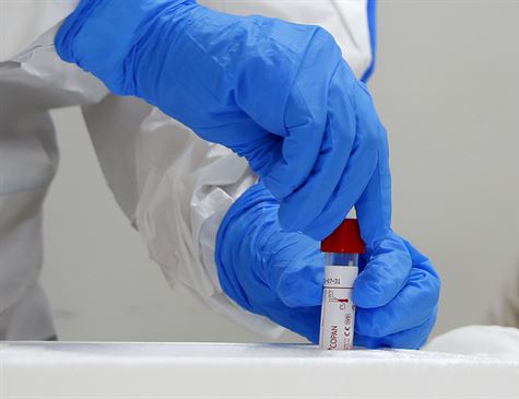 Secretaria de Saúde de Caruaru registra 71 novos casos de covid-19 e nenhuma morte
