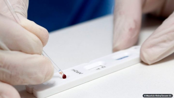 Caruaru registra 21 novos casos de covid-19 e 34 pacientes recuperados