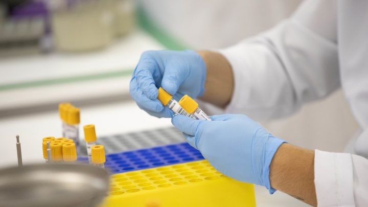 Caruaru registra mais de 10 mil casos de covid-19 e 9.501 pacientes recuperados