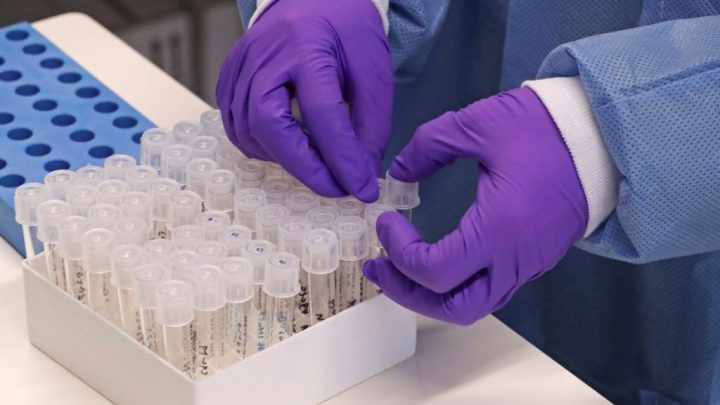 Caruaru registra 31 novos casos de covid-19 e 50 recuperados nas últimas 24 horas