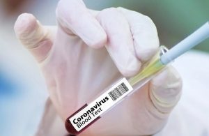 Caruaru registra 61 novos casos de covid-19 e nenhuma morte nas últimas 24 horas