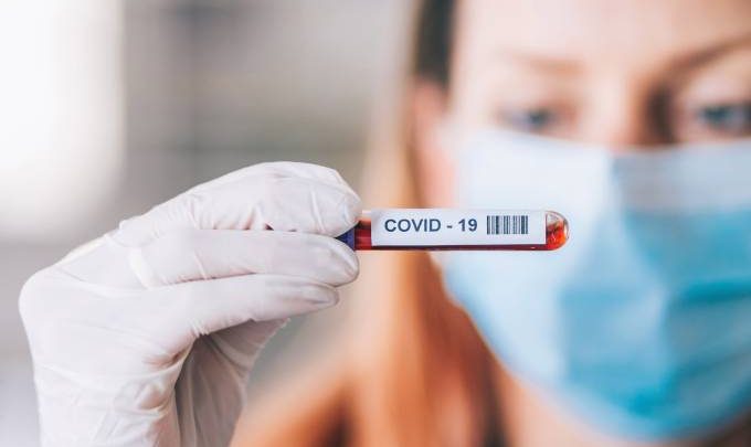 Caruaru registra 58 novos casos de covid-19 nas últimas 24 horas