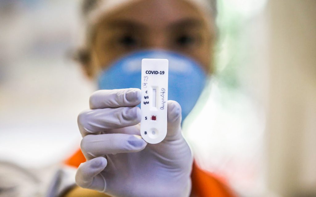 Pernambuco confirma 486 novos casos de covid-19 e 24 novas mortes