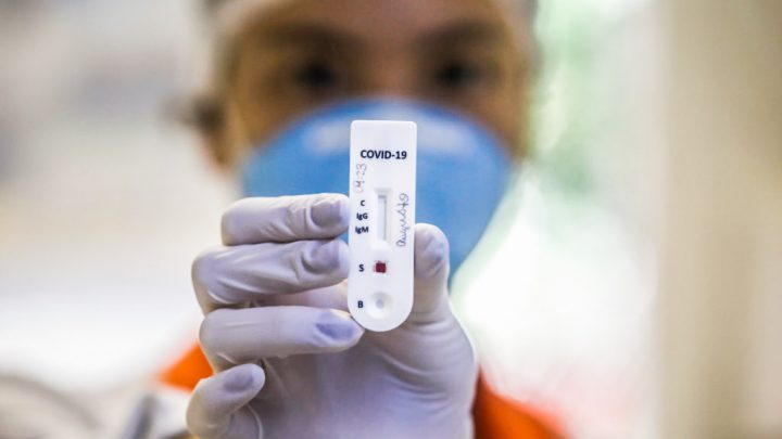 Pernambuco confirma 486 novos casos de covid-19 e 24 novas mortes