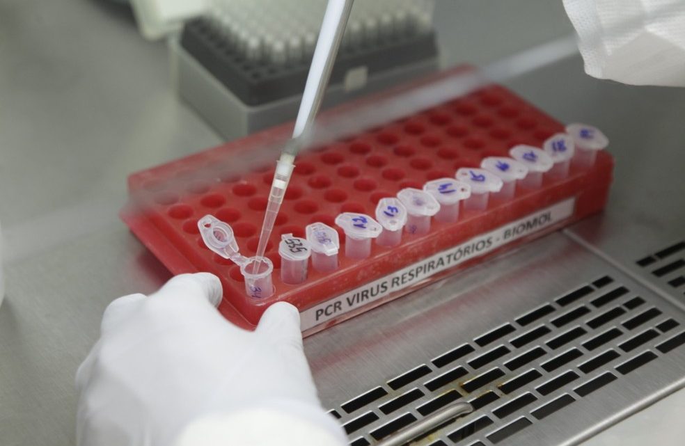 Caruaru registra 39 novos casos de Covid-19 e mais uma morte