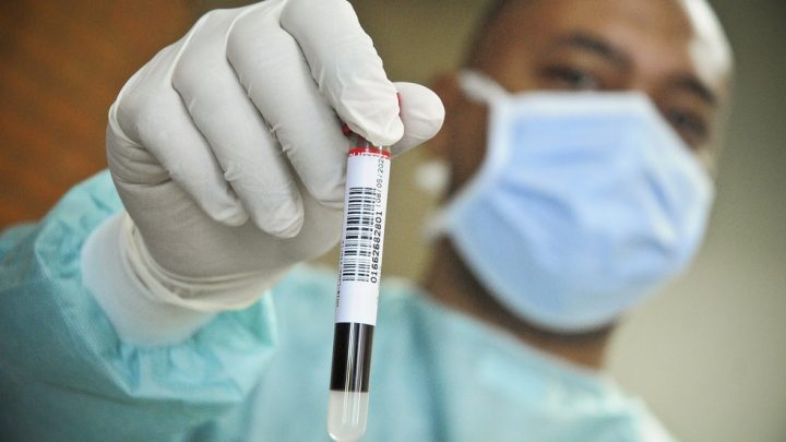 Pernambuco registra 258 novos casos de Covid-19 e 13 mortes