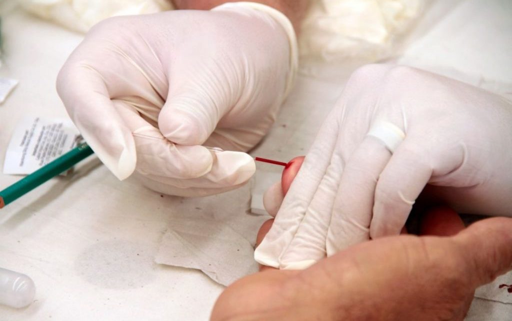 Secretaria de Saúde-PE registra 746 novos casos de Covid-19 e 22 novas mortes Secretaria de Saúde-PE registra 746 novos casos de Covid-19 e 22 novas mortes