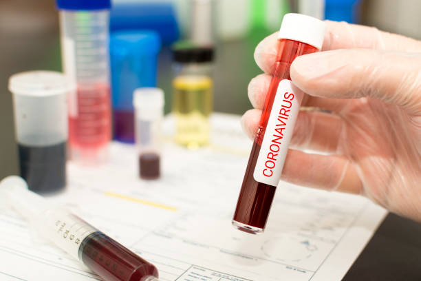 Caruaru registra 137 novos casos de Covid-19 e mais uma morte Caruaru registra 137 novos casos de Covid-19 e mais uma morte