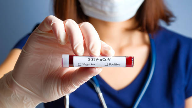 Pernambuco registra 1.133 novos casos de Covid-19 e 14 novas mortes