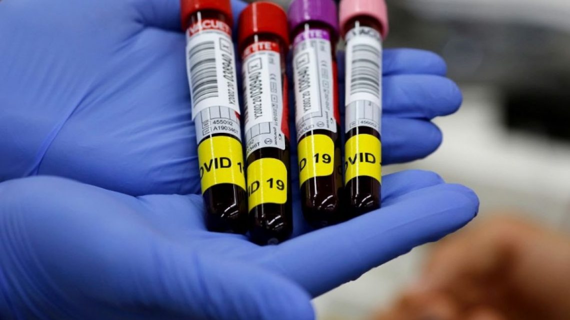 Pernambuco registra 1.702 novos casos de covid-19 e mais 18 mortes