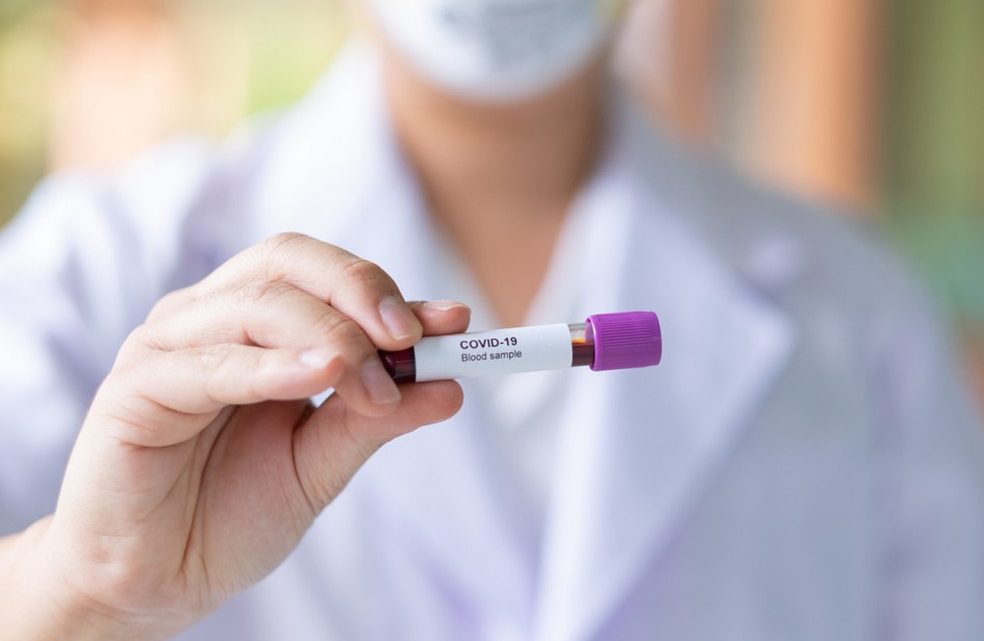 Caruaru registra 88 novos casos de Covid-19 e mais uma morte Caruaru registra 88 novos casos de Covid-19 e mais uma morte